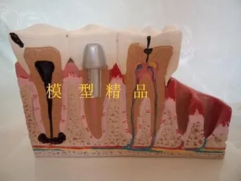 žmogaus Burnos patologija Kartu Modelį Medicinos Mokymo priemones dantų modelio nemokamas pristatymas
